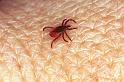 Ixodes_ricinus_F0316_Z_75_Veenendaal_Nederland
