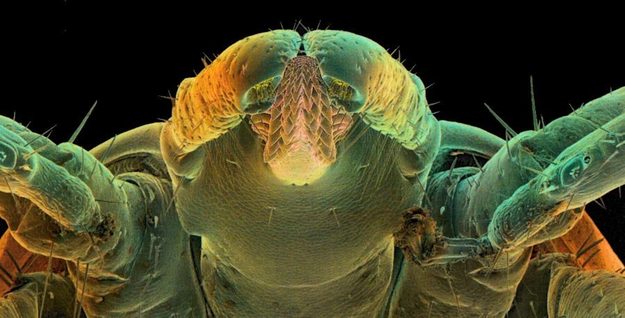 Electron microscopy scanning of Ixodes ricinus head